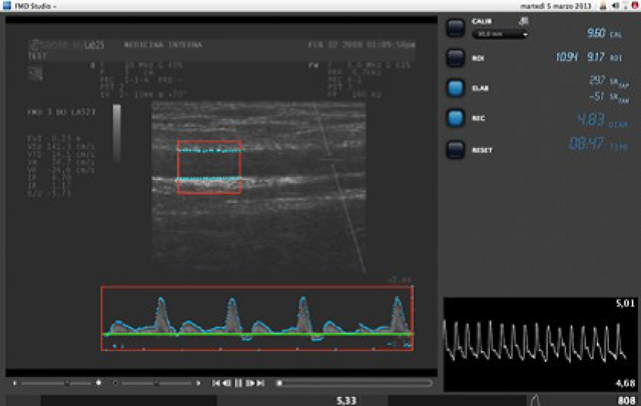 FMD-Measurement FMD-Measurement