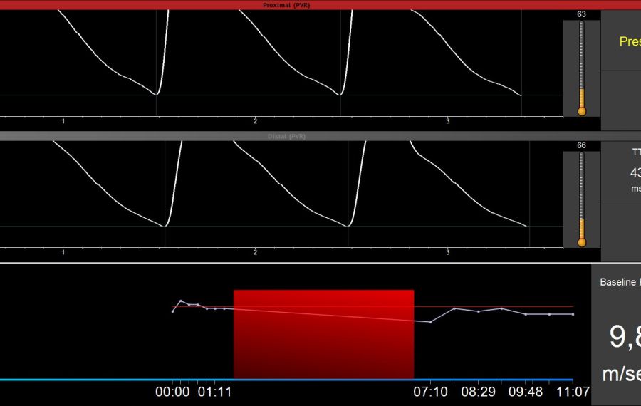 FMS Measurement FMS Measurement