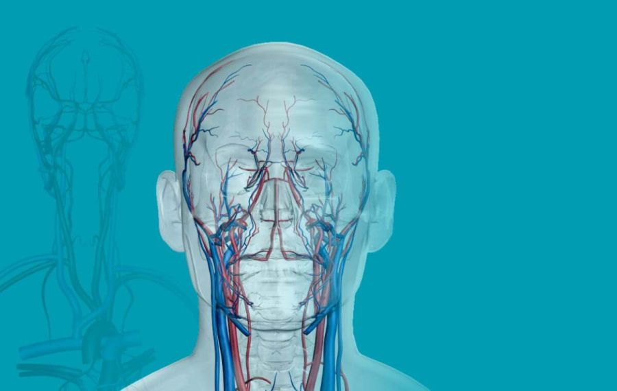 Cerebrovascular Testing Cerebrovascular Testing