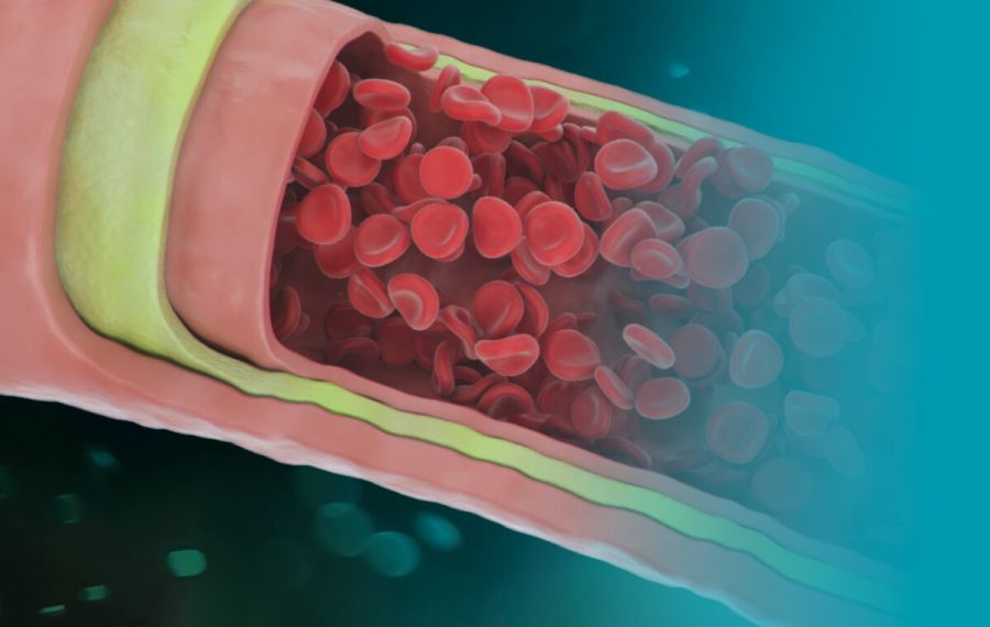 Endothelial Testing Endothelial Testing