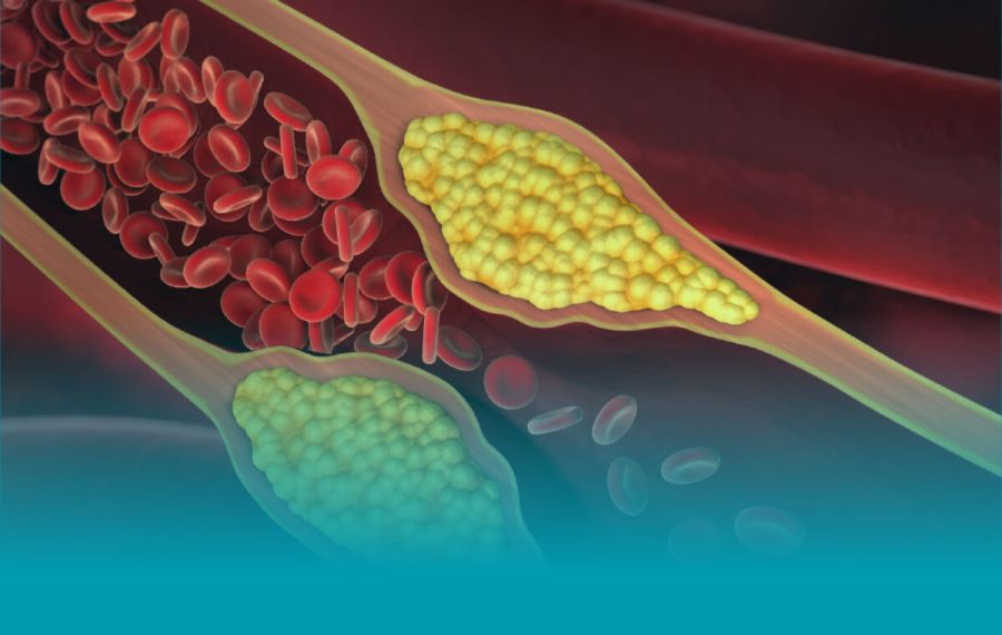 Peripheral-Vascular Testing Peripheral-Vascular Testing